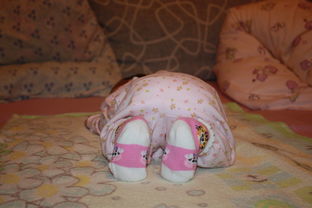 医院代生孩子发烧在家怎么处理